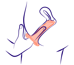 Préservatif interne placé correctement dans le vagin vu de côté.